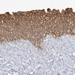LARS Antibody, Novus Biologicals 0.1mL; Unlabeled:Antibodies, Polyclonal